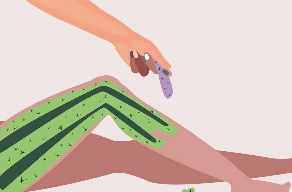 Sunvital Nişantaşı Lazer Epilasyonun Avantajları